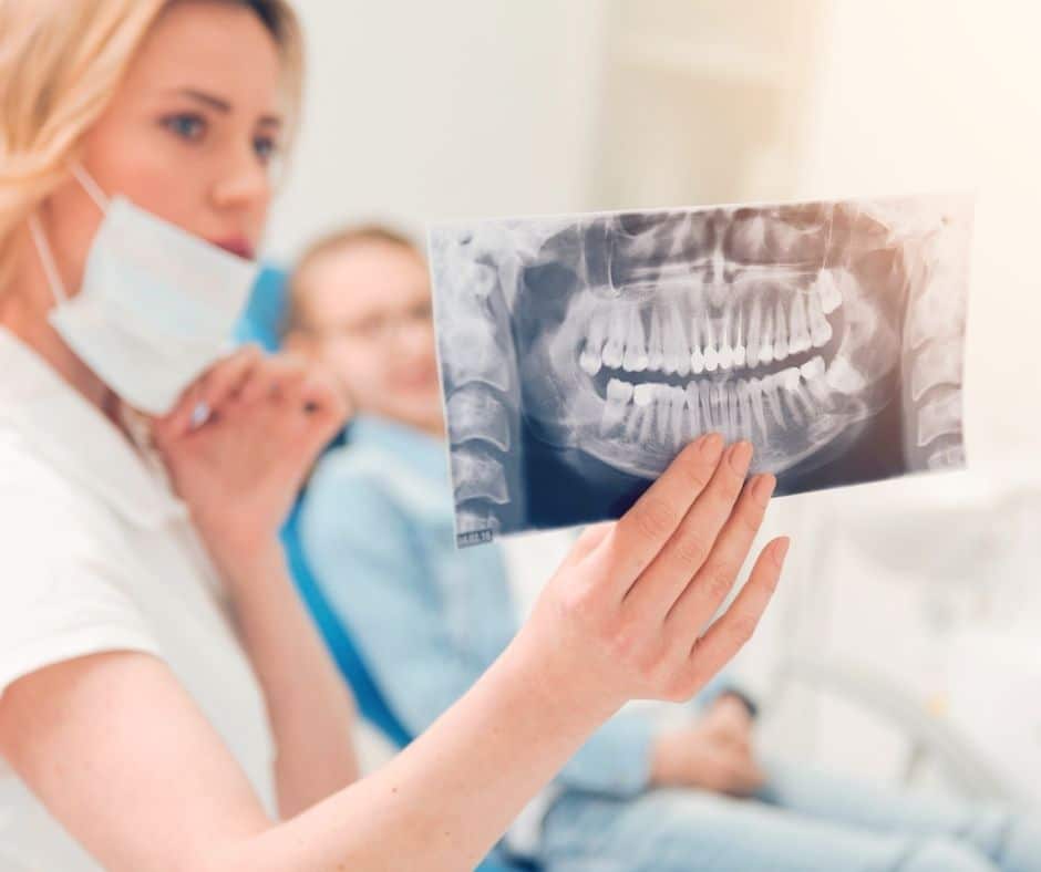 xray of wisdom teeth